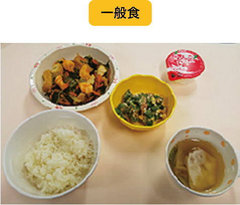 一般食